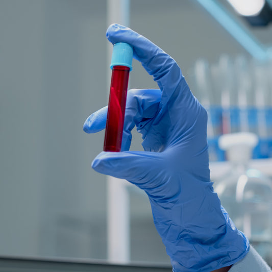 Home Lab Test Collection - Free Sample Pickup – EssaLaboratory