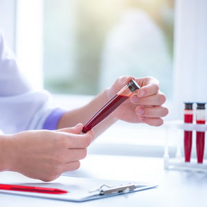 Malaria Parasitic Load