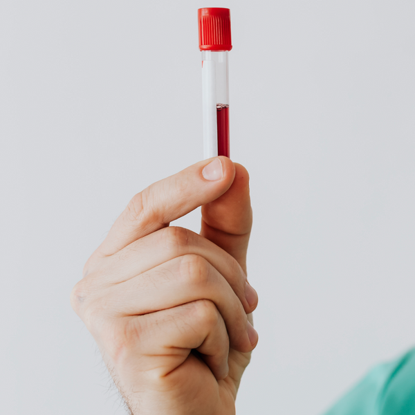 Red Cell Antibody Screening & Identification