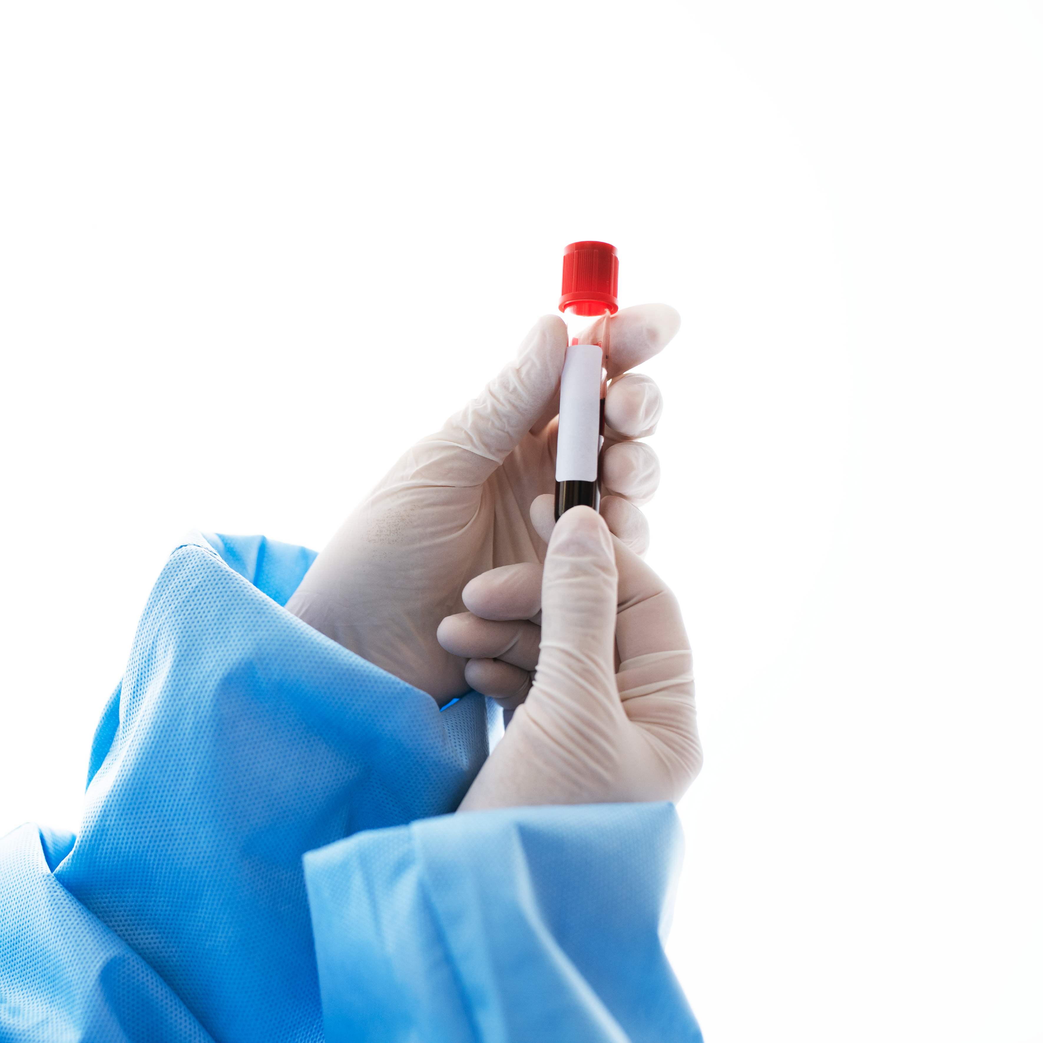 Pap Smear