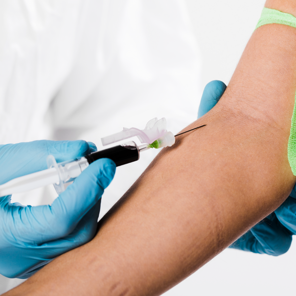 Fna Lab Test FNA with Procedure - Essa Laboratory โ EssaLaboratory