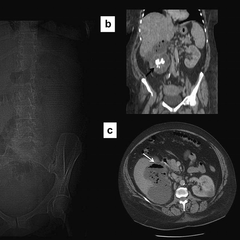 MRI Abdomen Plain EssaLaboratory