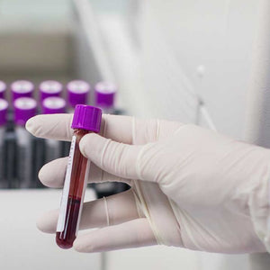 RPR (Rapid Plasma Reagin)