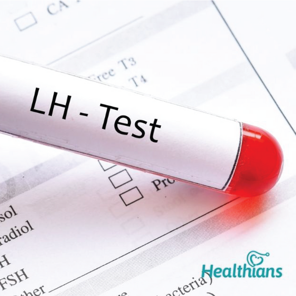 LH (Luteinizing hormone) Dr Essa Laboratory and Diagnostic Centre