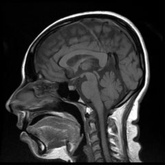 MRI Brain (Full Study) Plain Dr Essa Laboratory and Diagnostic Centre