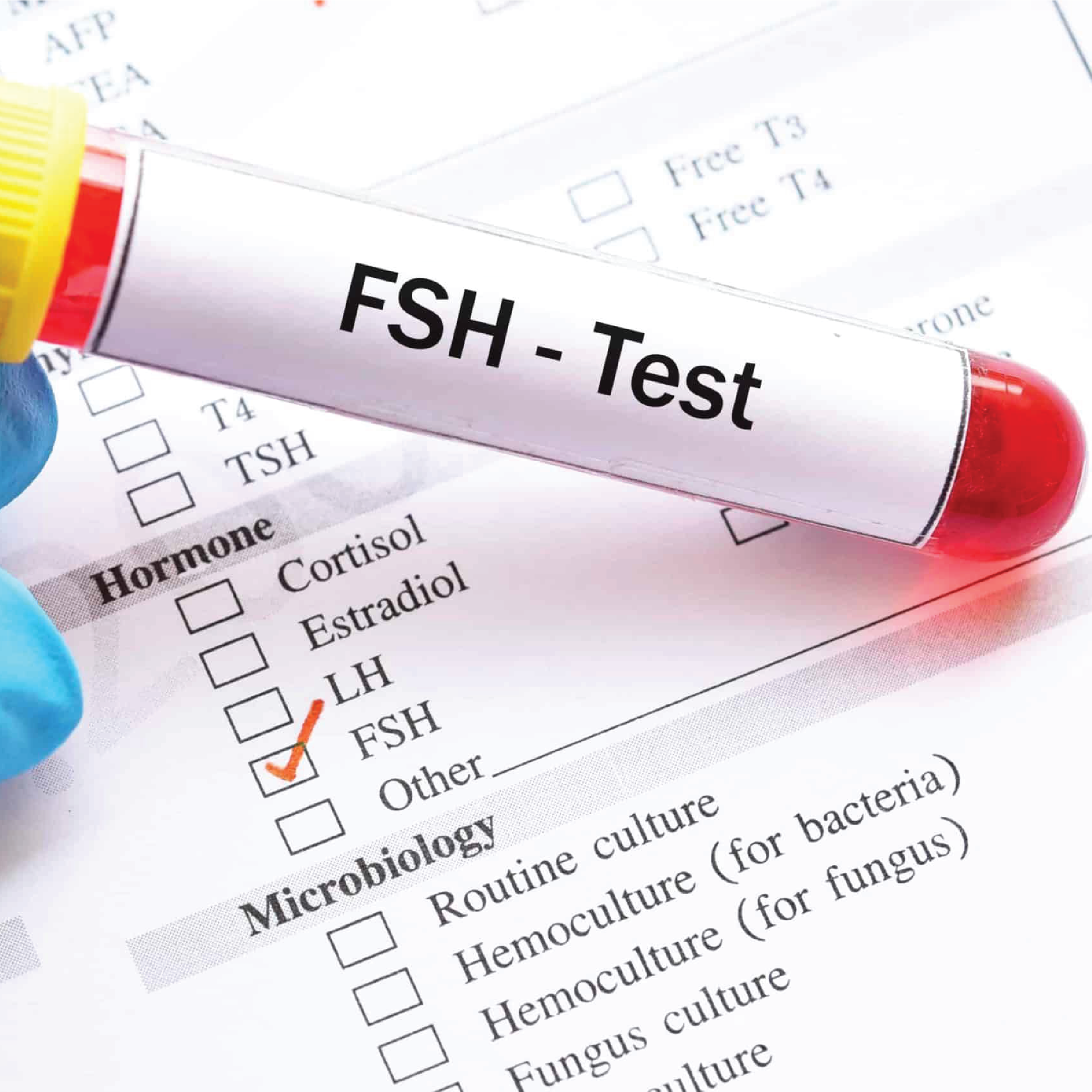 Fsh Lab FSH (Follicle-Stimulating Hormone) - Essa Laboratory – EssaLaboratory