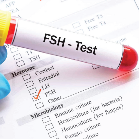 FSH (Follicle-Stimulating Hormone) Dr Essa Laboratory and Diagnostic Centre