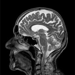 MRI Brain (Full Study) with Contrast EssaLaboratory