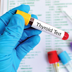 U/S Thyroid Dr Essa Laboratory and Diagnostic Centre