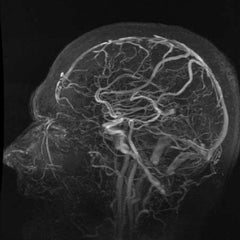 MRI Brain MRA / MRV Plain EssaLaboratory