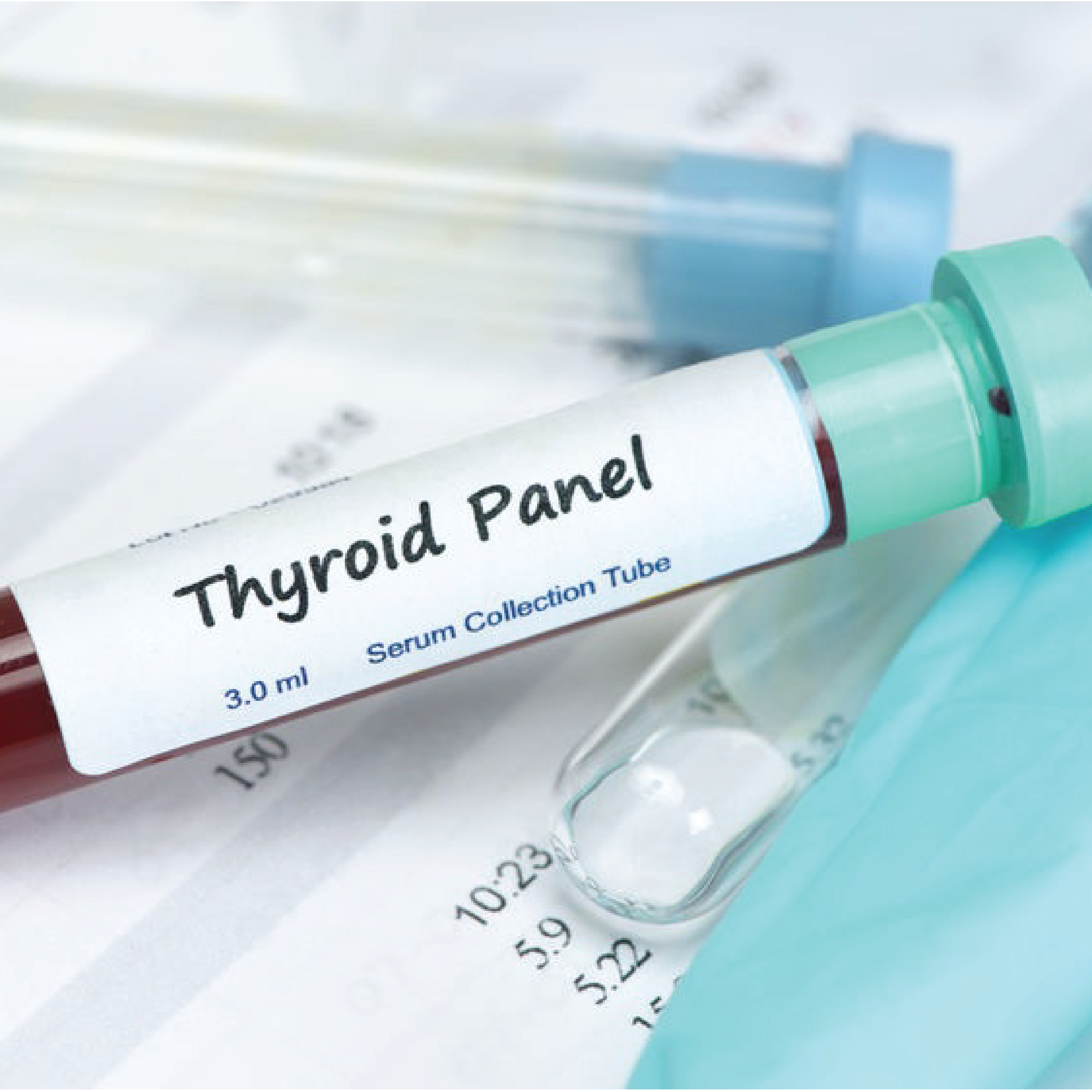 THYROID PROFILE (T3, T4, TSH)