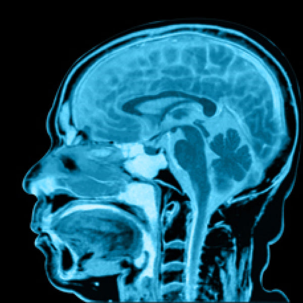 MRI Face Plain EssaLaboratory