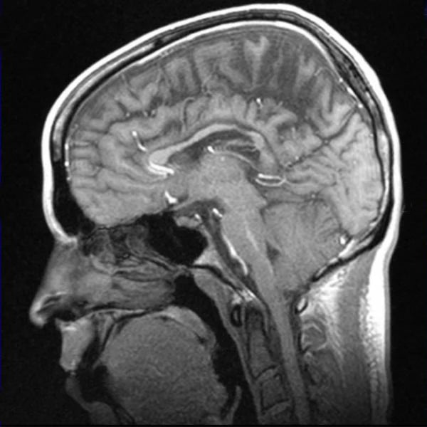 MRI Face with Contrast