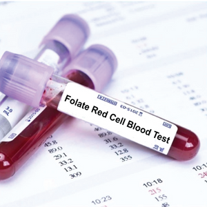 Folate (Folic Acid) Serum