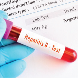 Hepatitis B Profile