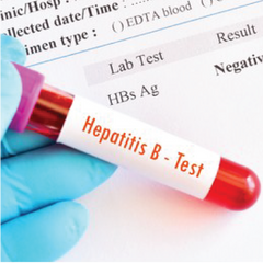 Hepatitis B Profile Dr Essa Laboratory and Diagnostic Centre