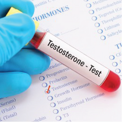Testosterone (Serum) Dr Essa Laboratory and Diagnostic Centre