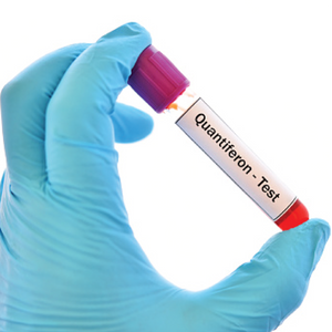 QuantiFERON-TB IGRA