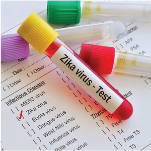 Zika Virus