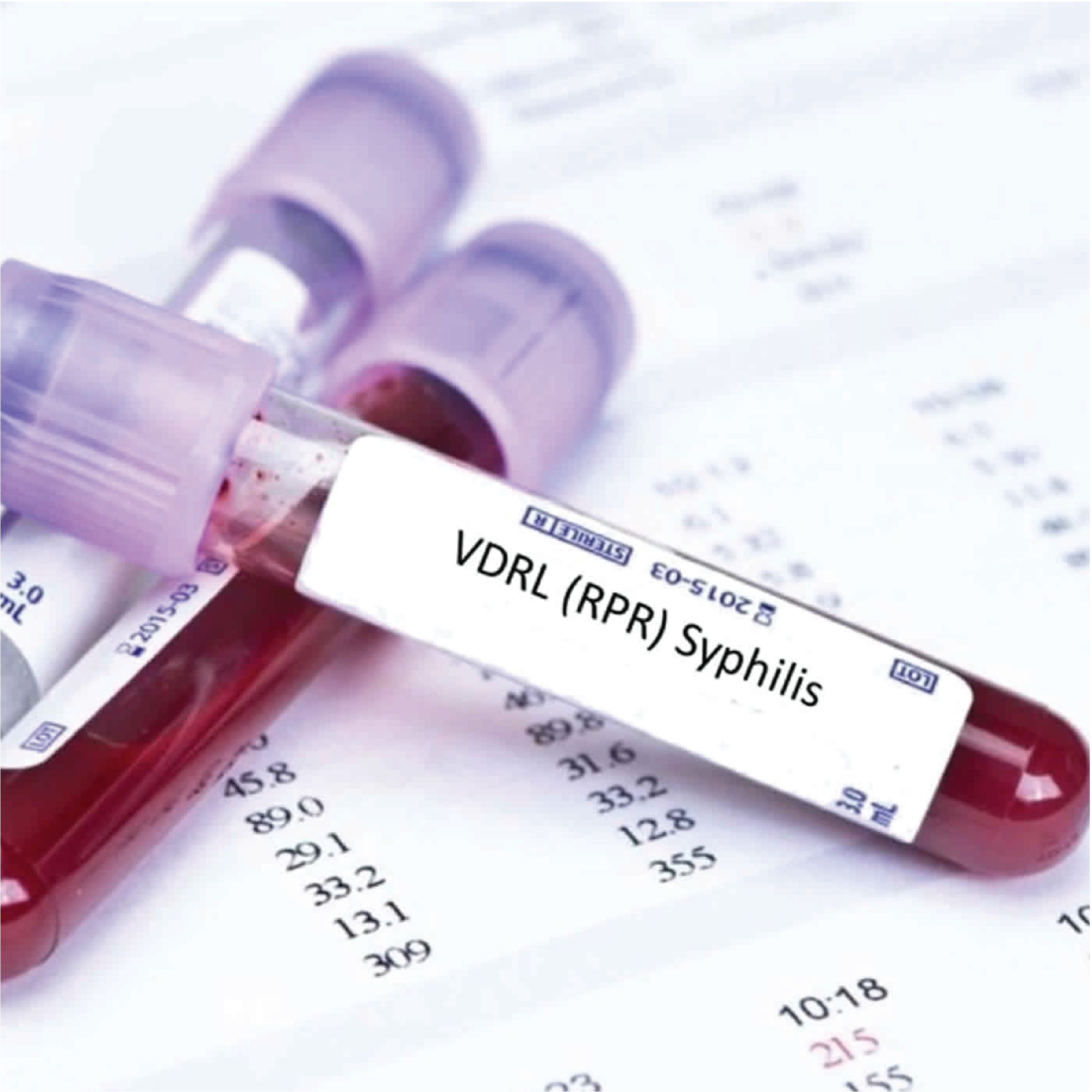 VDRL / RPR