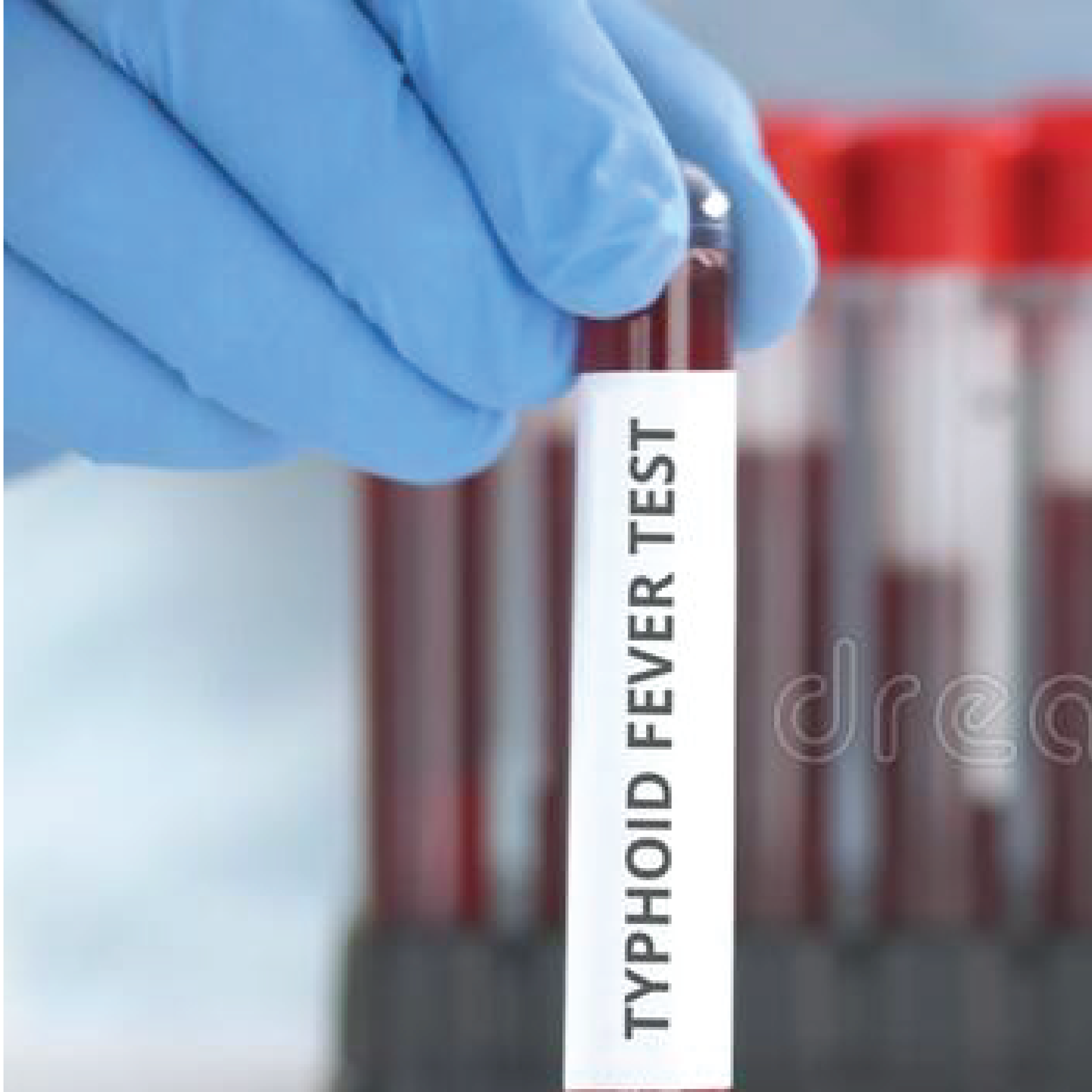 Typhoid Preliminary Screening Test