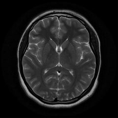 MRI Brain & Orbit Plain EssaLaboratory