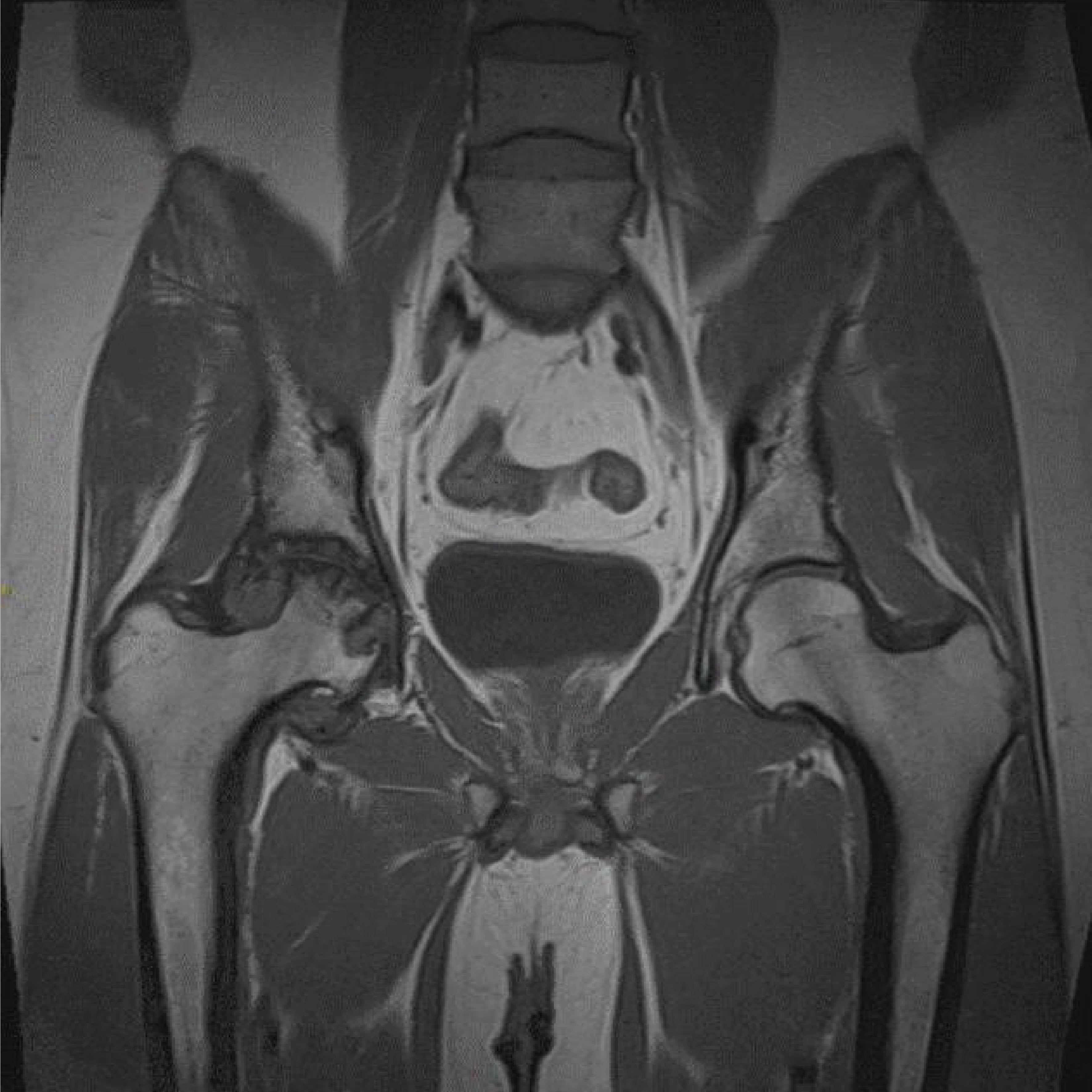 MRI Abdomen with Contrast