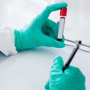 Very low density lipids (VLDL)