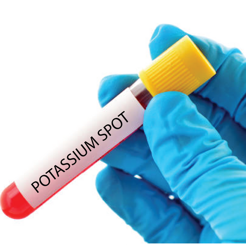 Potassium (Spot) Dr Essa Laboratory and Diagnostic Centre