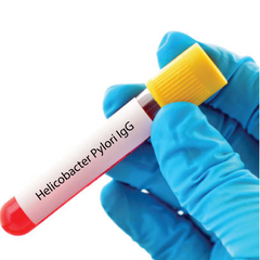 Helicobacter Pylori IgG Dr Essa Laboratory and Diagnostic Centre