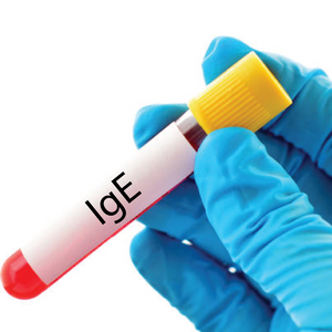 IgE
