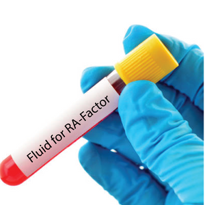 Fluid for RA-Factor