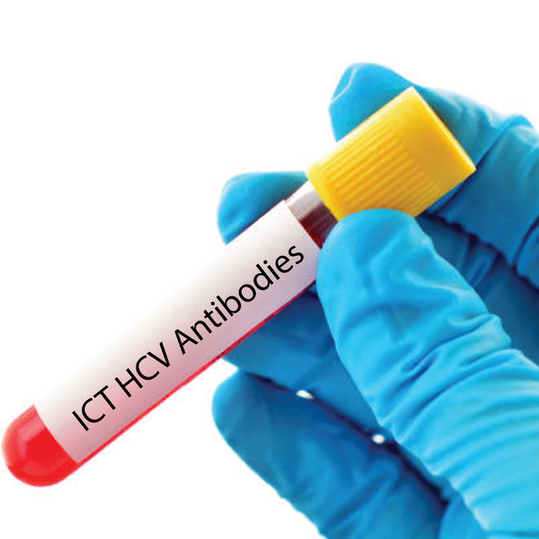 ICT HCV Antibodies