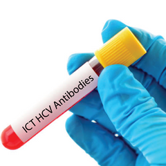 ICT HCV Antibodies Dr Essa Laboratory and Diagnostic Centre