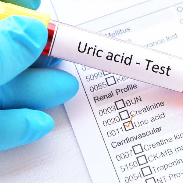 Serum Uric Acid Dr Essa Laboratory and Diagnostic Centre