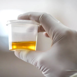 Urine - Sugar/Glucose