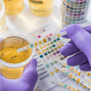 URINE FOR REDUCING SUGAR