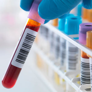 FBS (Glucose Fasting )