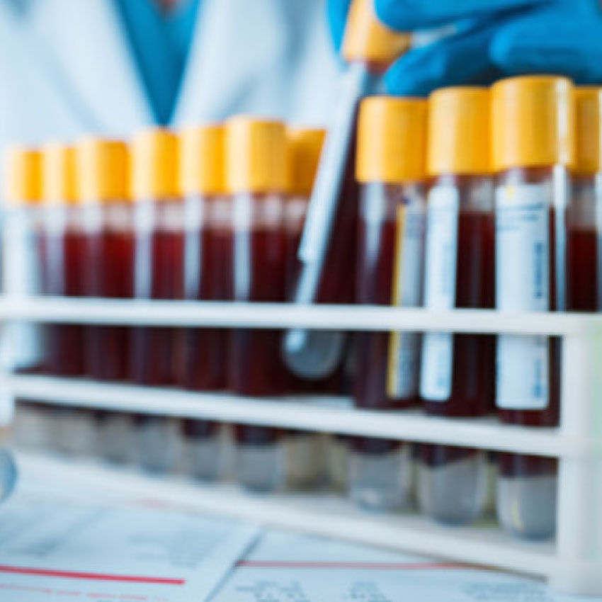 Hemoglobin Profile (Hb)