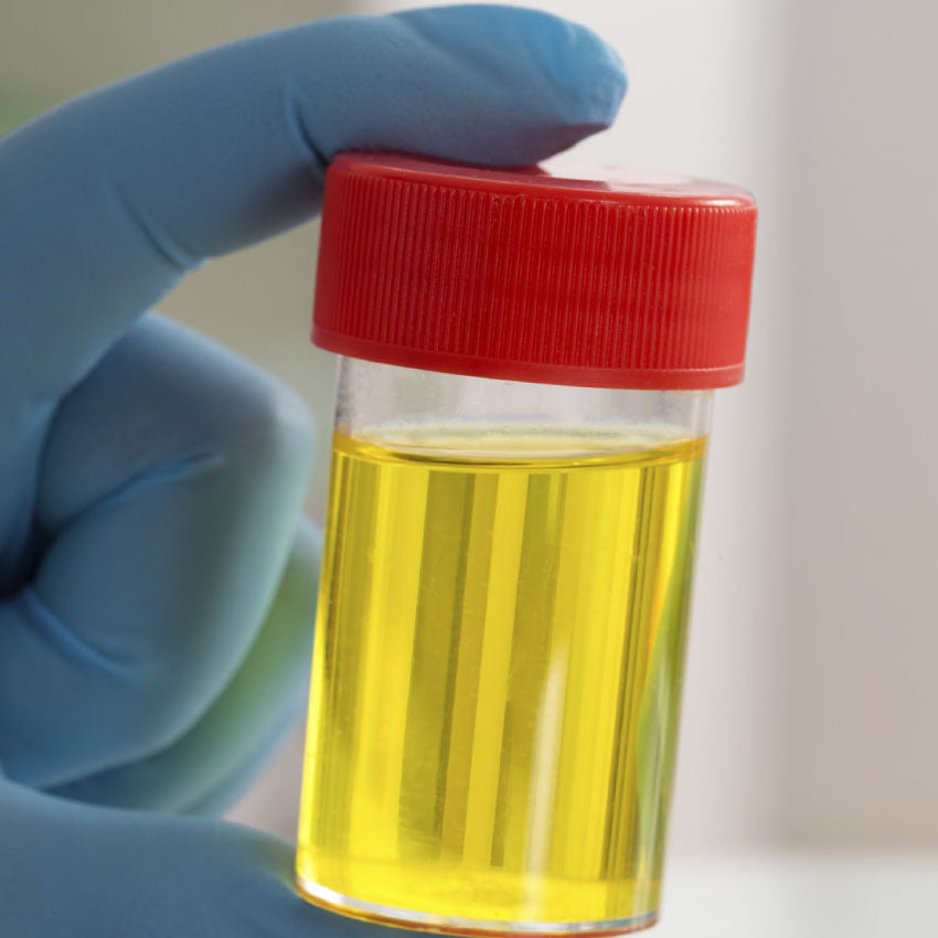 Urinary Uric acid (Spot)