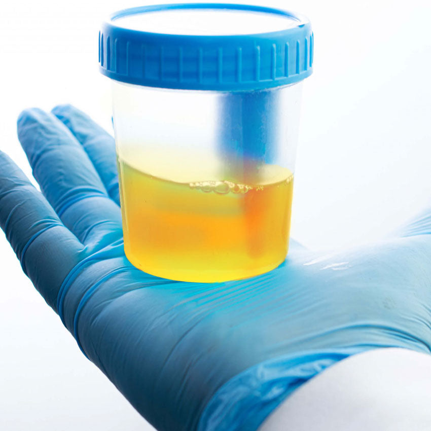 Urinary Potassium (Spot)