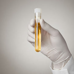 Urine Pregnancy Test EssaLaboratory