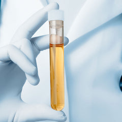 Urine for Cannabinoids Dr Essa Laboratory and Diagnostic Centre